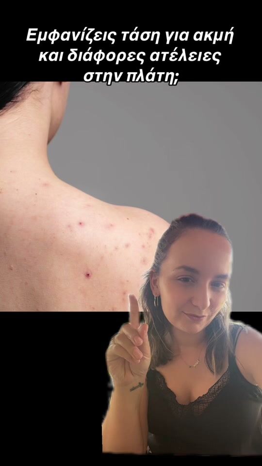 Acne on the back? No no no ????