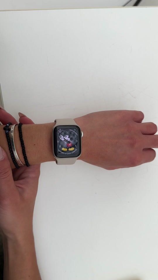 Affordable & Stylish Apple Watch worth choosing!